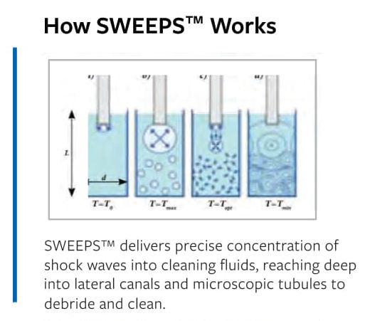 How Sweeps Works